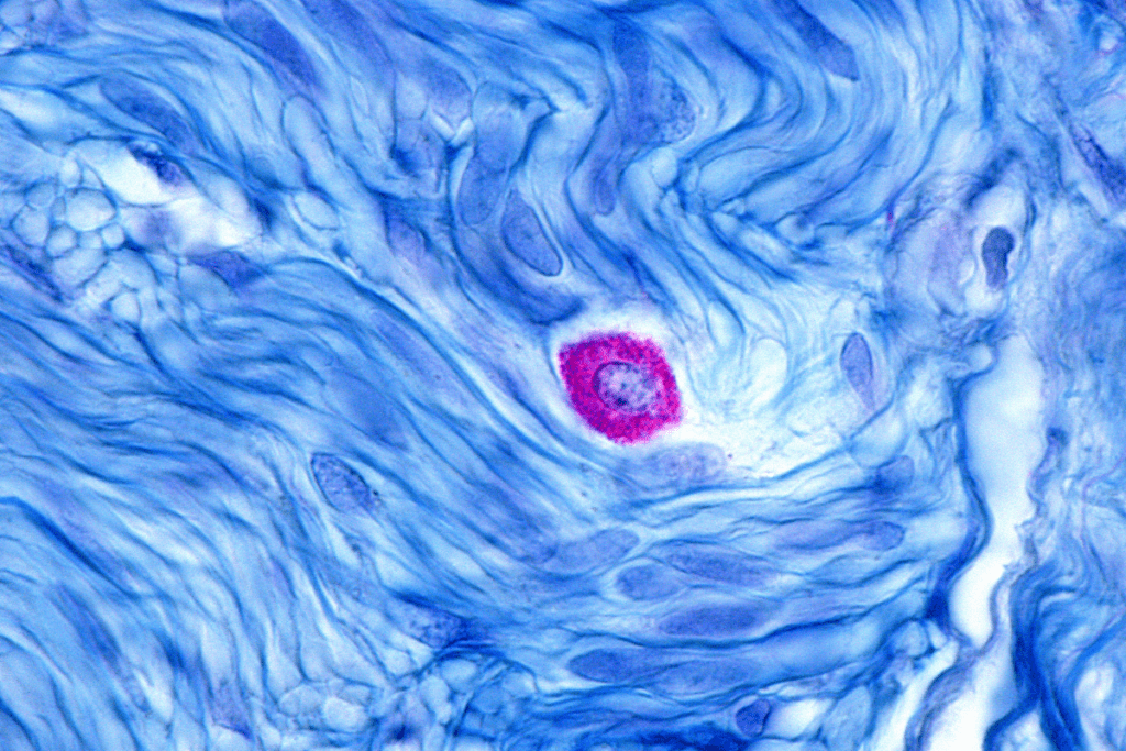 Mast Cell with cytoplasm