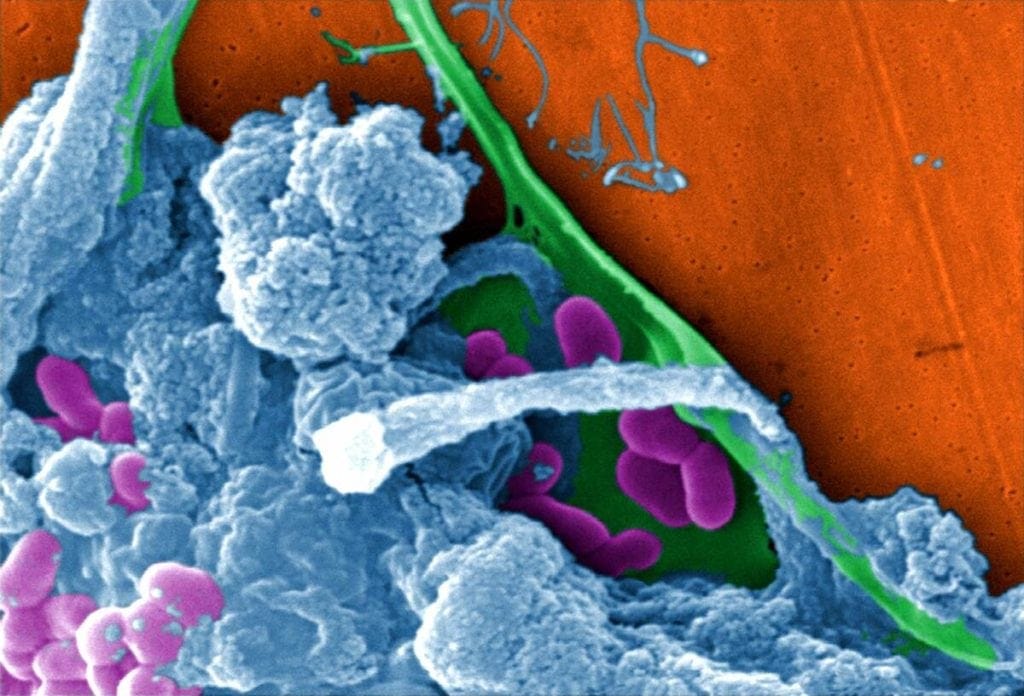 Biofilm Mast Cell 360