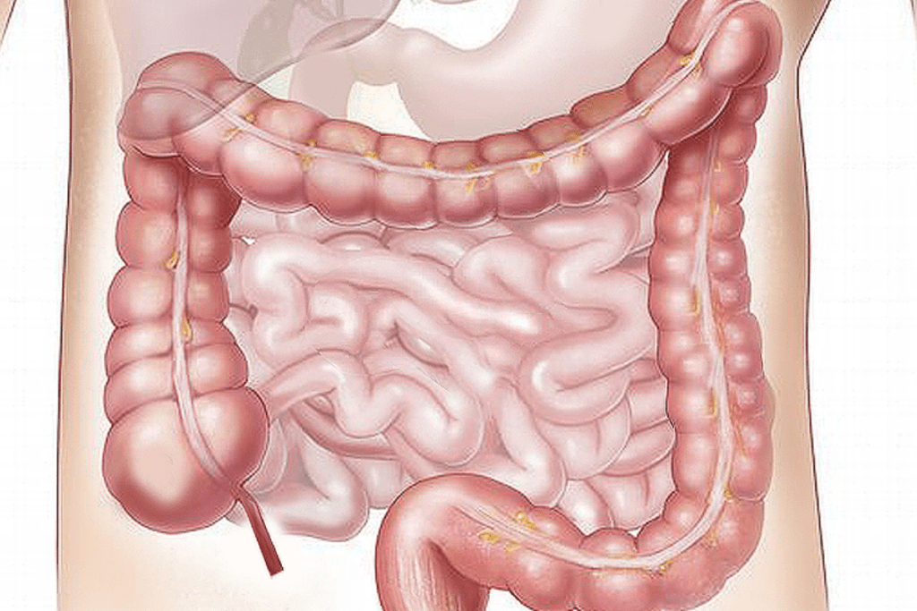 Intestine Mast Cell 360