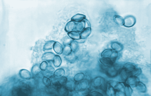 fungal overgrowth